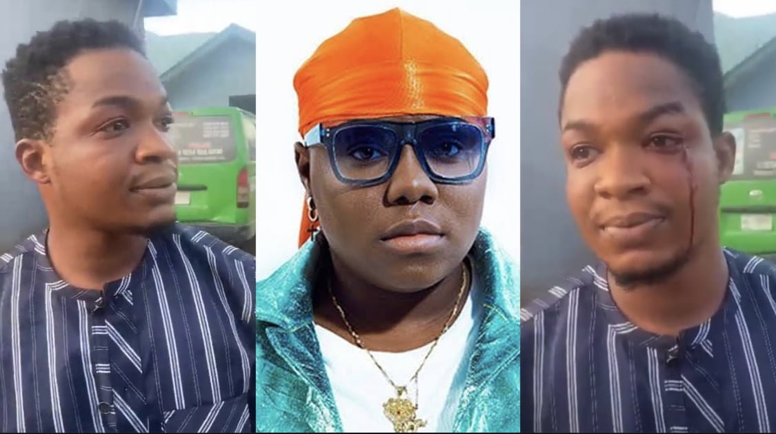 UNIBEN student bloodied after singer Teni reportedly orders security to beat him in Asaba [video]