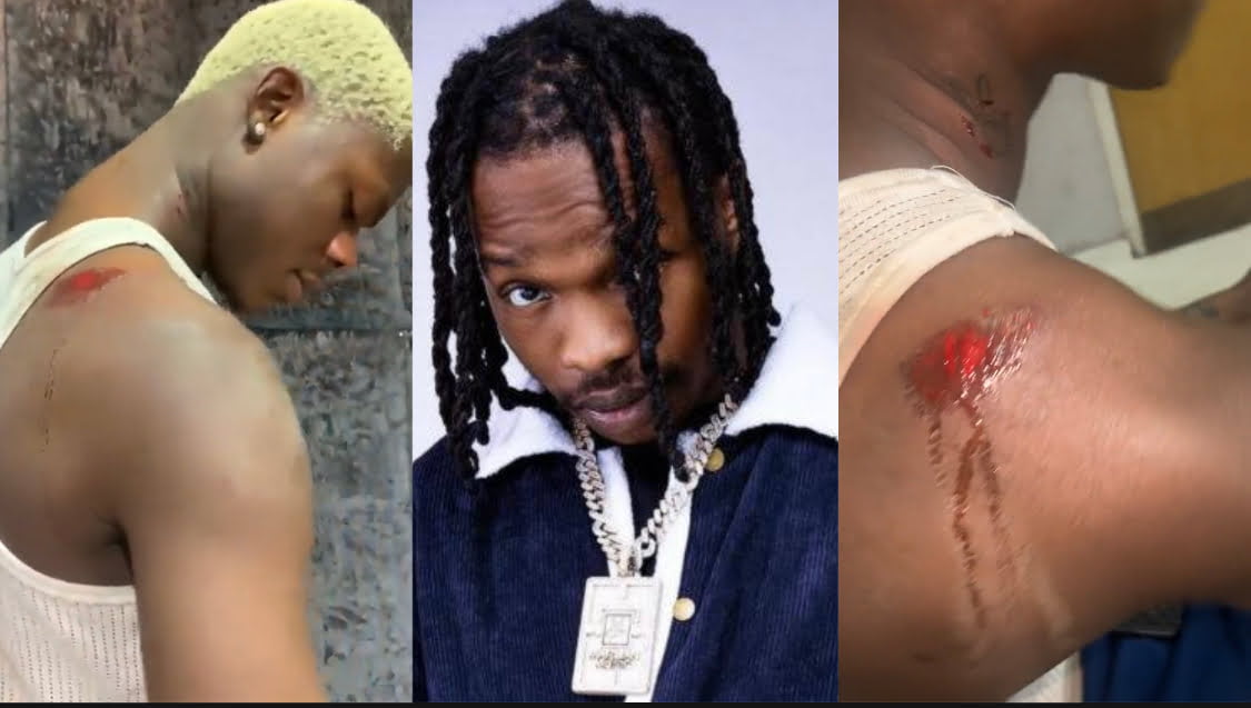 Singer Mohbad beaten by Label boss Naira Marley’s boys for allegedly demanding change of Manager [video]