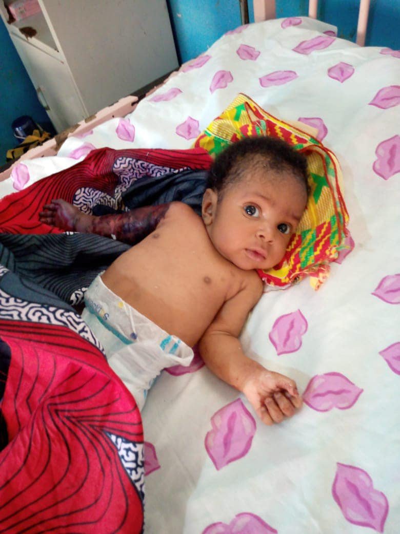 Outrage as Father beats, breaks hand of 2-month-old baby with hanger for ‘disturbing’ his sleep in imo [photos]