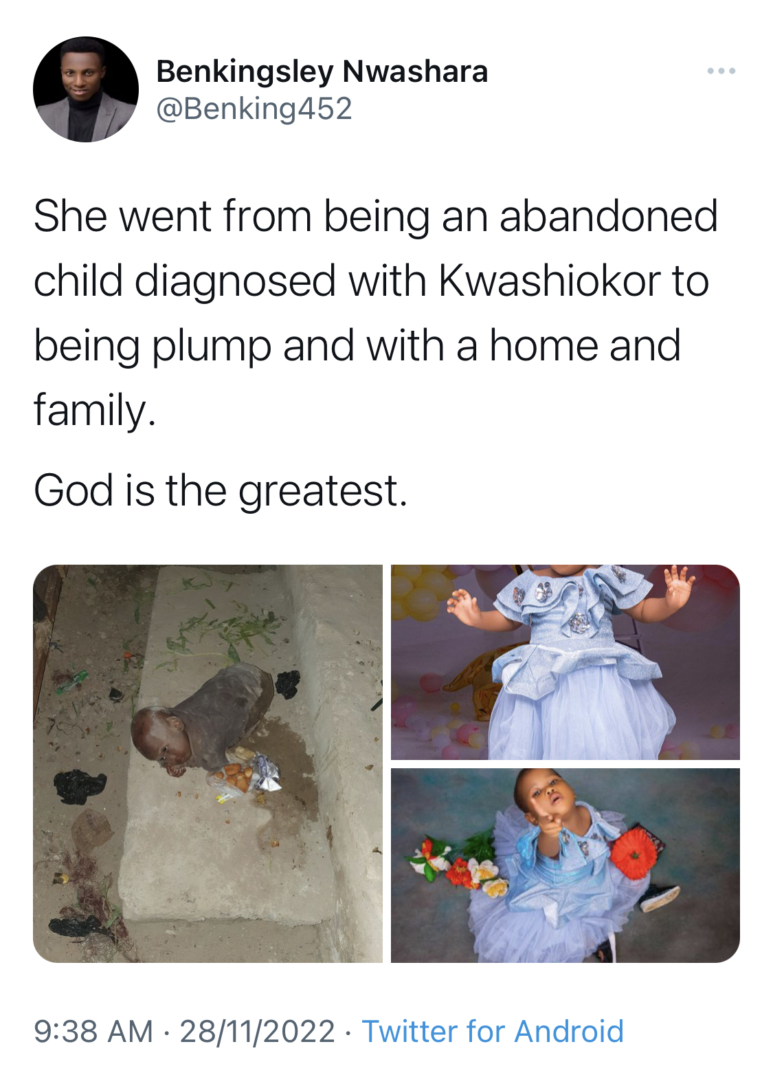 Man shares transformation of little girl rescued after being abandoned by mentally challenged mother [photos]