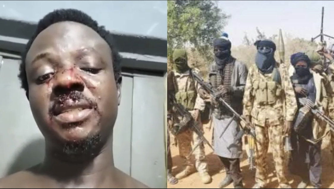 Bandits are now in Lagos – Man shares chilling tale of how he was almost beheaded by kidnappers [video]