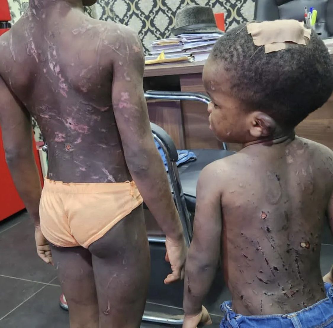 Police arrest Couple for brutalizing 5 and 2 year old children [photos]