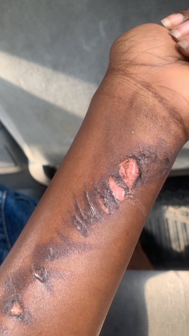 Lady narrowly escapes death after falling live wire electrocuted her while strolling in Lagos [photos]