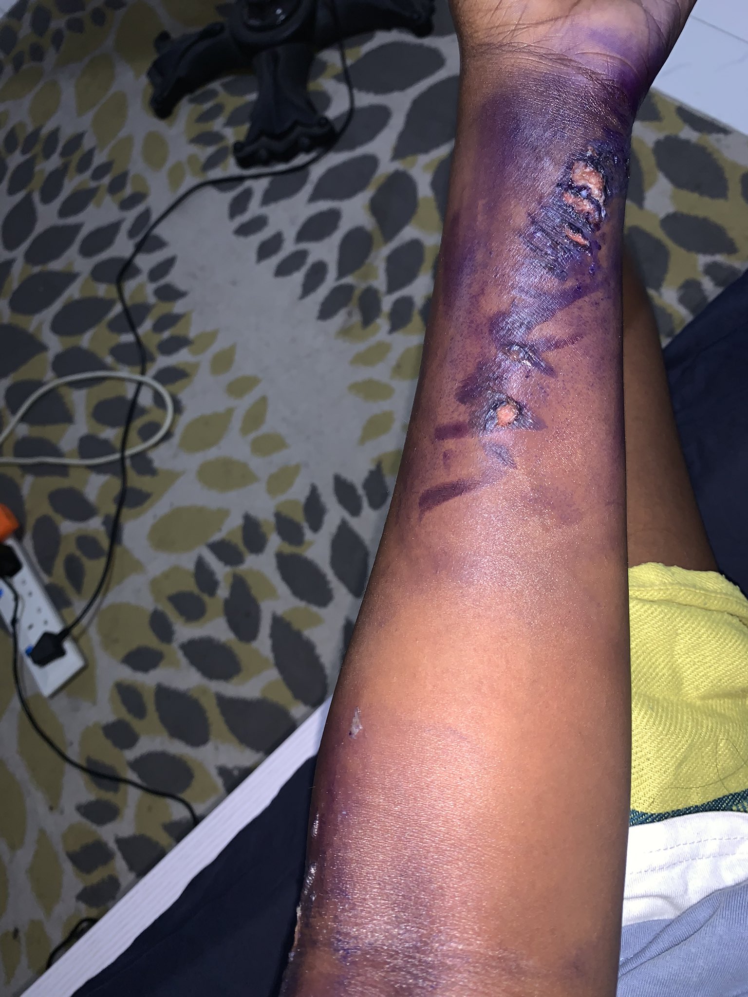 Lady narrowly escapes death after falling live wire electrocuted her while strolling in Lagos [photos]