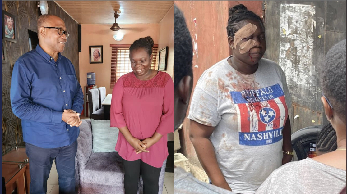 She is an icon of democracy – Peter Obi gushes as he visits woman who voted despite being brutalized in Lagos [photos]