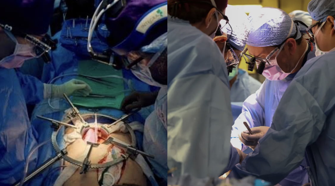 Man undergoes first successful pig to human kidney transplant 
